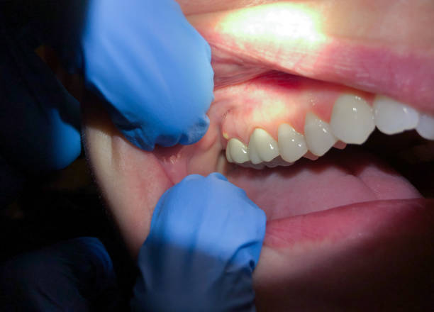 Fast & Reliable Emergency Dental Services in RI