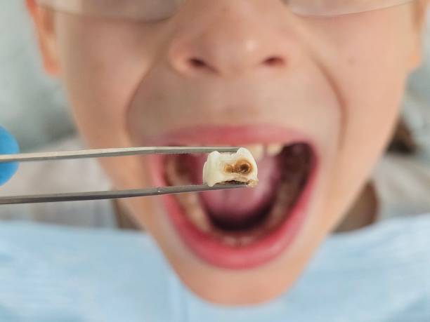 Best Pediatric Emergency Dentist in Newport East, RI